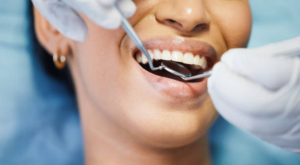 Best Emergency Wisdom Teeth Removal in Bigfork, MT